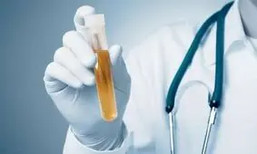 سرطان را با یک آزمایش ادرار تشخیص دهید