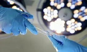 تشکیل سالانه ۳۵هزار پرونده پزشکی در کشور/ ۹ درصد شکایات در حوزه جراحی‌های زیبایی