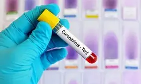 شدت بیماری کووید-۱۹ را می‌ توان پیش از موعد پیش‌ بینی کرد