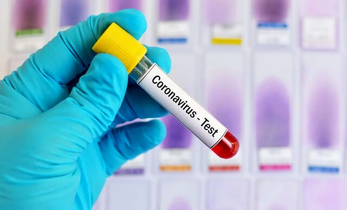 شدت بیماری کووید-۱۹ را می‌ توان پیش از موعد پیش‌ بینی کرد