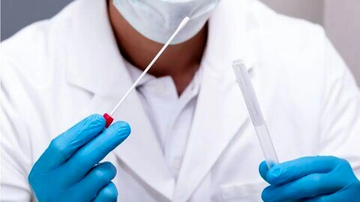 عدد درج شده در تست کرونا به چه معنا است؟