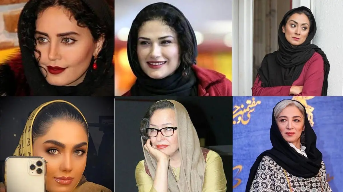 ماجرای خانم‌های بازیگری که زشت شدند!