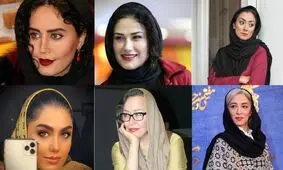 ماجرای خانم‌های بازیگری که زشت شدند!