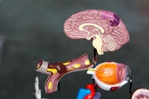 کشف ساختار هایی که به مقابله با تومور های مغزی کمک می‌ کند