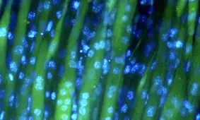 "چمن" گزینه جدیدی برای تولید گوشت آزمایشگاهی واقعی ‌تر!