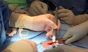 تشخیص بافت سرطانی در ۱۵ ثانیه