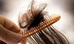 با خشکی مو‌ ها در تابستان چه کنیم؟