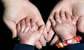 گم شدن نیمی از پانسمان هایی که یونسیف به پروانه ای های ایران داده در وزارت بهداشت/ نهادهای امنیتی و قضایی ورود کنند/ اگر ای‌بی فروخته، من و خانواده ام را اعدام کنید