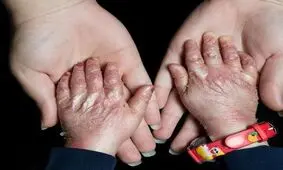 گم شدن نیمی از پانسمان هایی که یونسیف به پروانه ای های ایران داده در وزارت بهداشت/ نهادهای امنیتی و قضایی ورود کنند/ اگر ای‌بی فروخته، من و خانواده ام را اعدام کنید