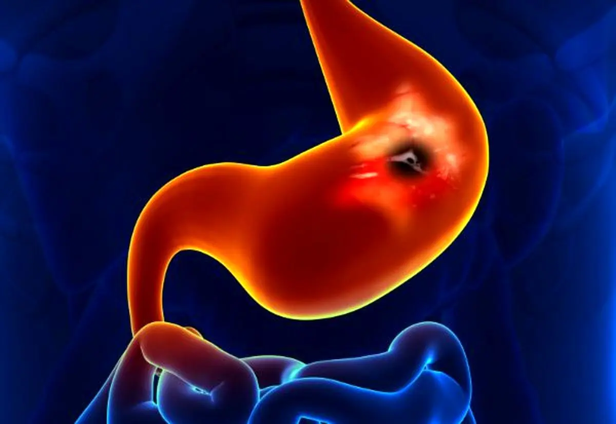 میکروموتورهای جدید دریافت داروهای حساس به بدن را ساده تر می کنند