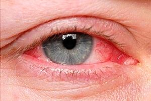 بیماری هایی که از راه چشم تشخیص داده می‌شوند
