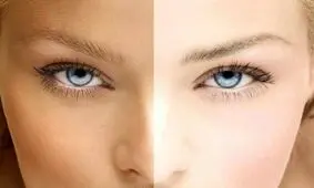 با این خوراکی‌ ها پوست خود را شفاف کنید