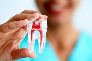 اطلاعات جامع در مورد لمینت دندان و کامپوزیت دندان