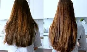 رشد سه برابری مو