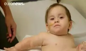 فیلم/ دختران دوقلوی به‌هم چسبیده بعد از ۱۷ ساعت عمل جراحی از هم جدا شدند