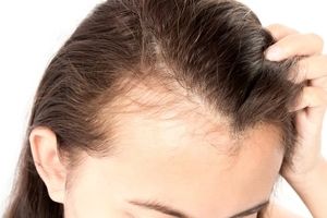 اسید معده نیز قادر به از بین بردن موی انسان نیست