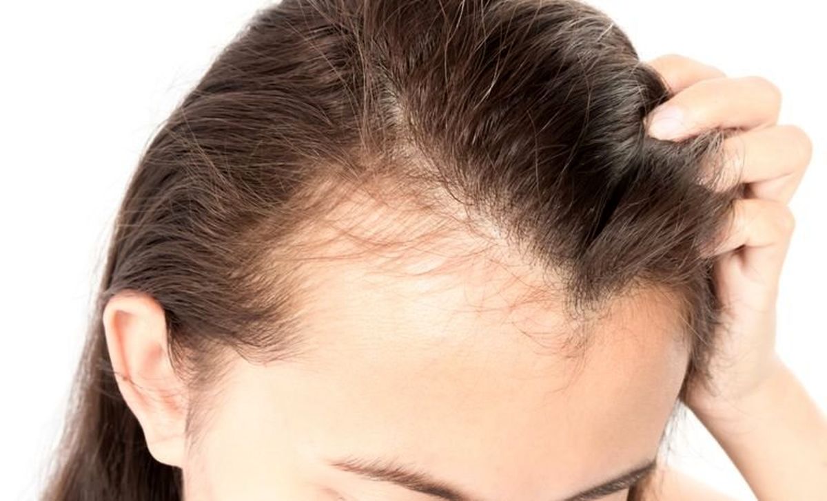 اسید معده نیز قادر به از بین بردن موی انسان نیست