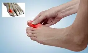 بیماری هایی که منجر به بروز درد در انگشت شست پا می‌شوند