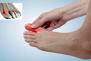 بیماری هایی که منجر به بروز درد در انگشت شست پا می‌شوند