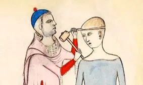 درمان عجیب و ترسناک سردرد در گذشته