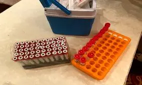 آیا تست‌های کرونا «دلتا» را تشخیص می‌دهد؟