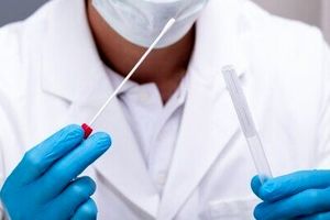 کمبود تست PCR حقیقت ندارد