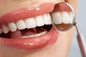 چهار دشمنی که سلامت دندان هایتان را تهدید می‌کنند