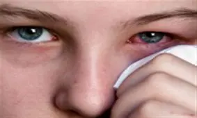 به بچه‌ها گوشزد کنید که چشم‌های خود را نمالند