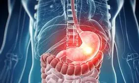 خوراکی‌ هایی که به معده شما آسیب می‌زنند