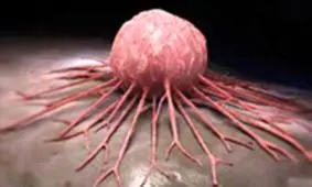 علائم سرطان را در دوران پاندمی جدی بگیرید