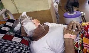 "قارچ سیاه" در کمین چه افرادی است؟