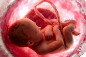 آخرین وضعیت سقط جنین در کشور