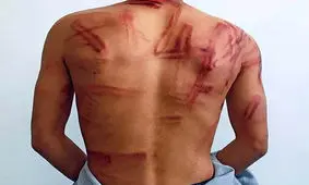 وضعیت یک عکاس پس از آزادی از بازداشت طالبان