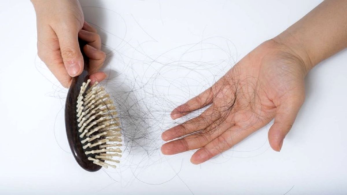 معرفی بهترین مکمل‌ها برای درمان ریزش مو/ نکاتی برای حفظ سلامت موها قبل از فصل پاییز