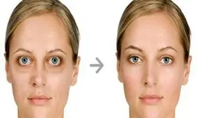 چشم تیروئیدی چه نشانه ای دارد؟