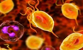 تریکومونیازیس، یک بیماری جنسی دردناک و مسری