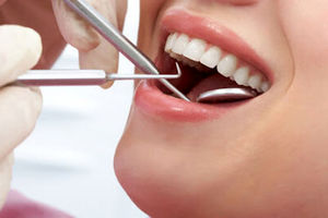 آثار مخرب سفید کردن دندان