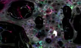 کشف حقایقی جالب درباره دومین مغز بدن