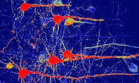 درمان نابینایی ناشی از سکته مغزی با ژن‌درمانی جدید
