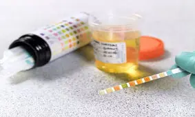 دفع پروتئین از ادرار چه علت‌هایی دارد؟