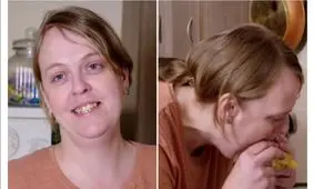 رژیم ۳۰ ساله و عجیب یک زن مبتلا به فوبیای گیاهی