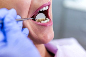 چگونه زخم های دهان را درمان کنیم؟