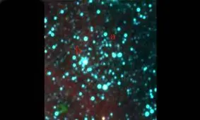 نخستین خوشه ستاره‌ای دوگانه قدیمی کشف شد