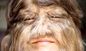 پرموترین و ترسناک ترین دختر جهان تغییر چهره داد