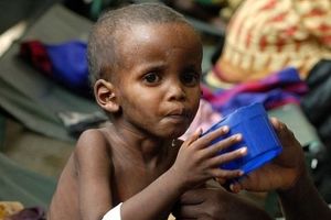 مردم کدام کشورها دچار سوءتغذیه هستند؟/ اینفوگرافیک