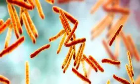 علل ژنتیکی مقاومت دارویی در بیماری "سل" شناسایی شد