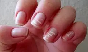 نشانه‌ها و علائم کمبود کلسیم در بدن