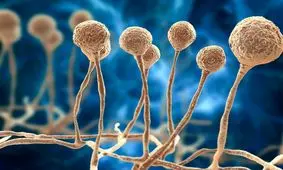 ۱۱ بیمار مشکوک به قارچ سیاه در استان مرکزی شناسایی شدند