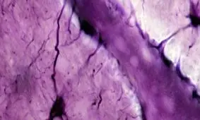 نوعی چربی مسئول انتقال پروتئین ایجاد کننده آلزایمر به مغز است