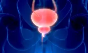 کیست مثانه چیست و چه علائمی دارد؟